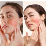 sensitive skin