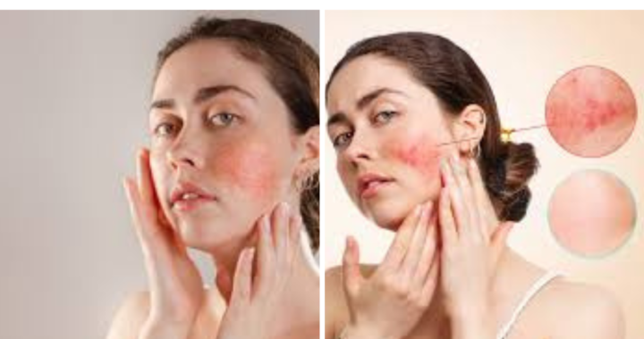sensitive skin